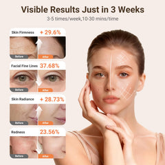 DCBBD full-face-coverage LED mask delivers even light exposure across the entire face.