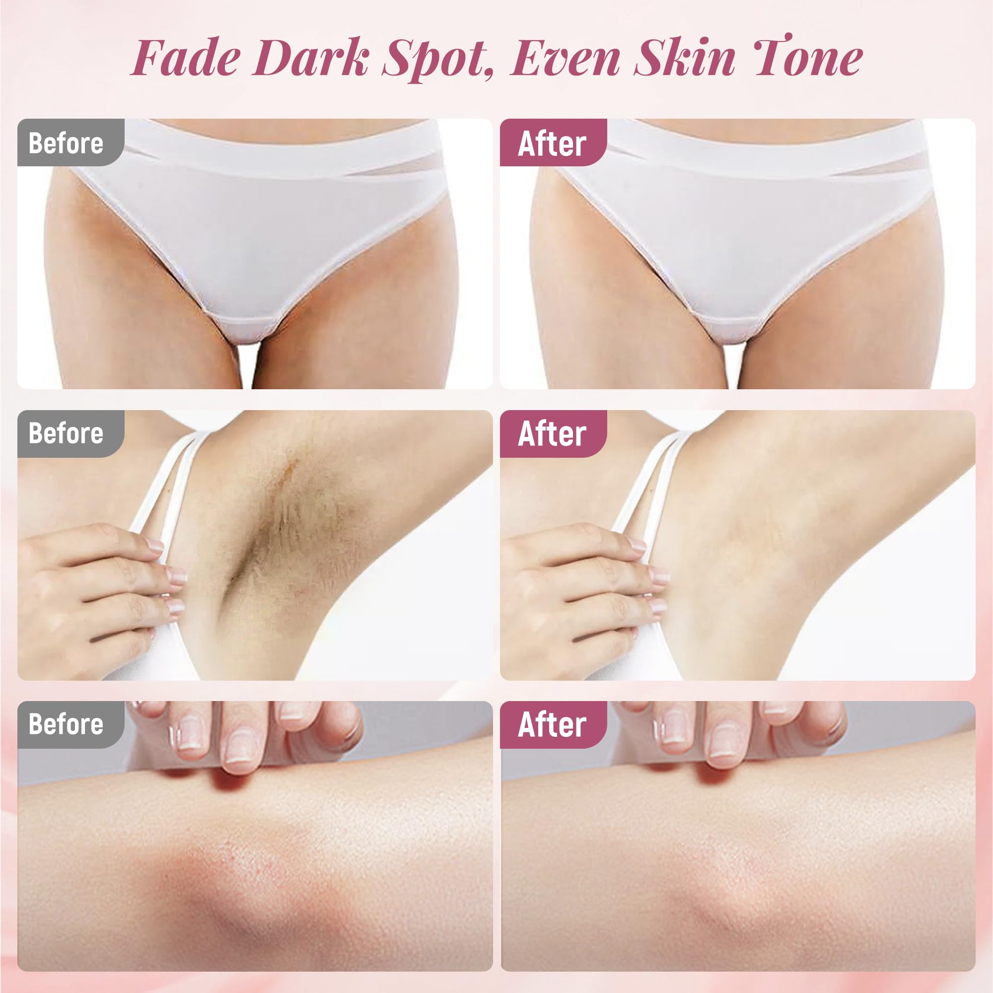 DCSCRK Bikini line brightening cream promotes smoother, even skin.