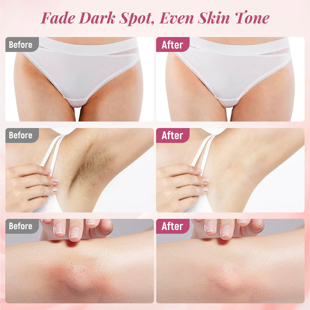 DCSCRK Bikini line brightening cream promotes smoother, even skin.