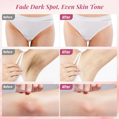 DCSCRK Bikini line brightening cream promotes smoother, even skin.