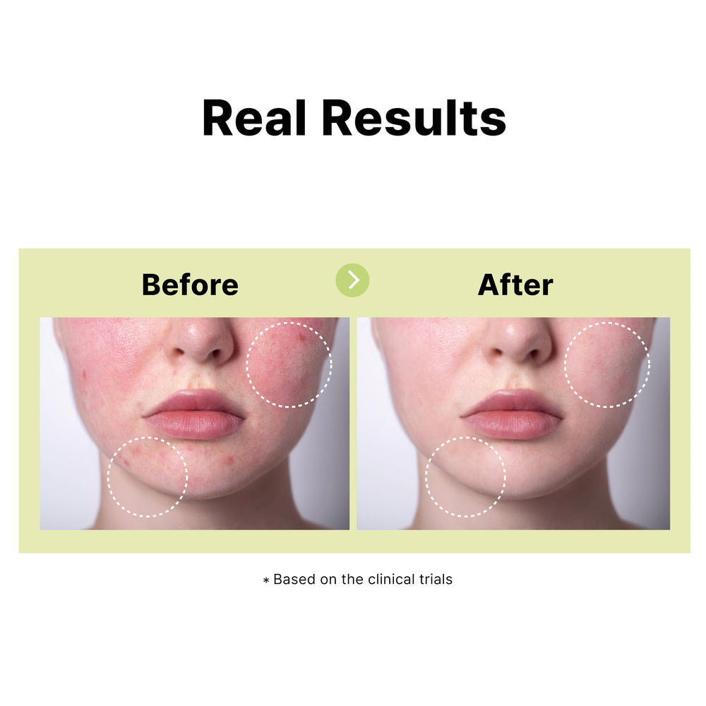 DearMYDEW azelaic serum texture swirl demonstrates lightweight, quick absorption