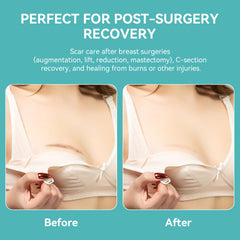 DEBOOB ultra-soft silicone close-up suitable for sensitive skin