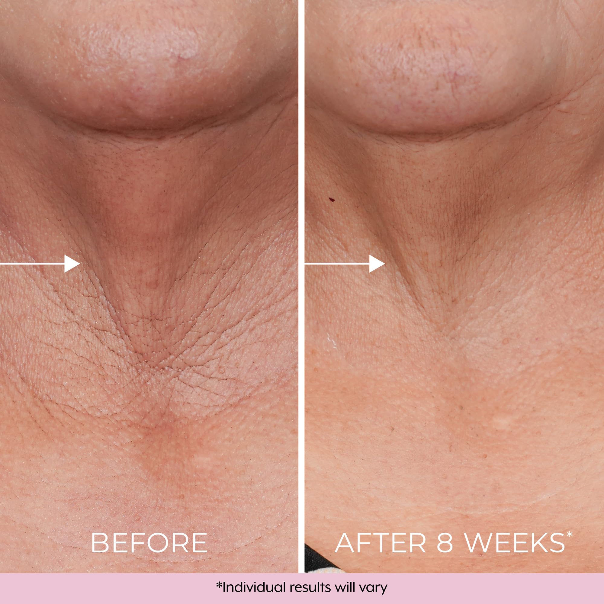 Dekliderm consumer-test results graphic shows firming feedback.
