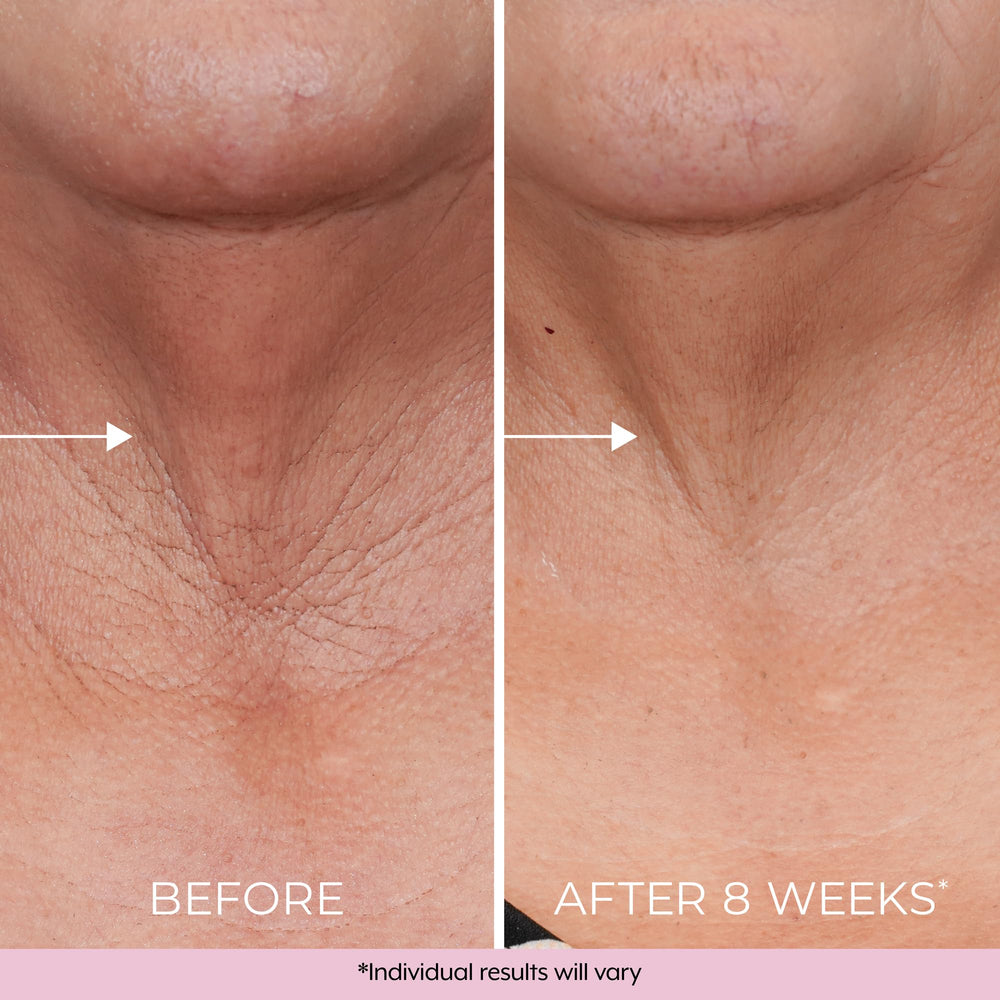 Dekliderm consumer-test results graphic shows firming feedback.