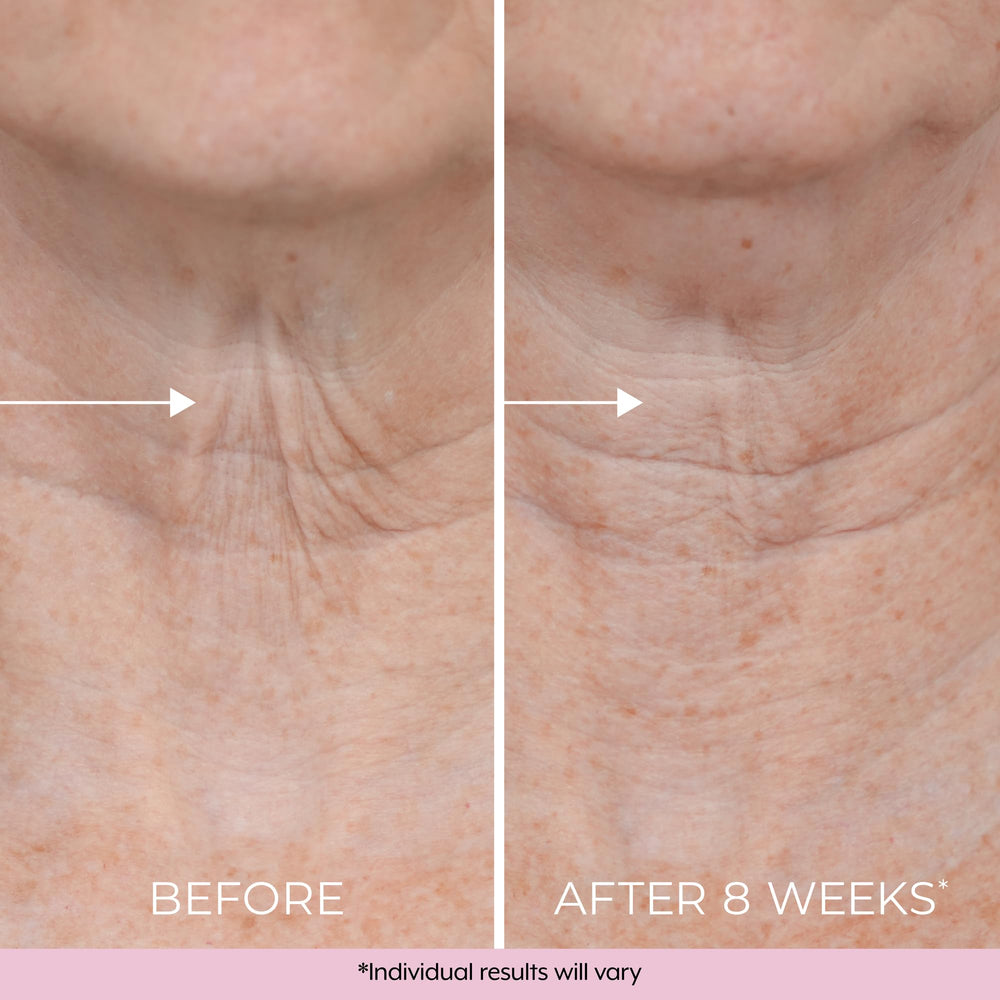 Dekliderm fragrance-free formula badge appeals to sensitive skin users.
