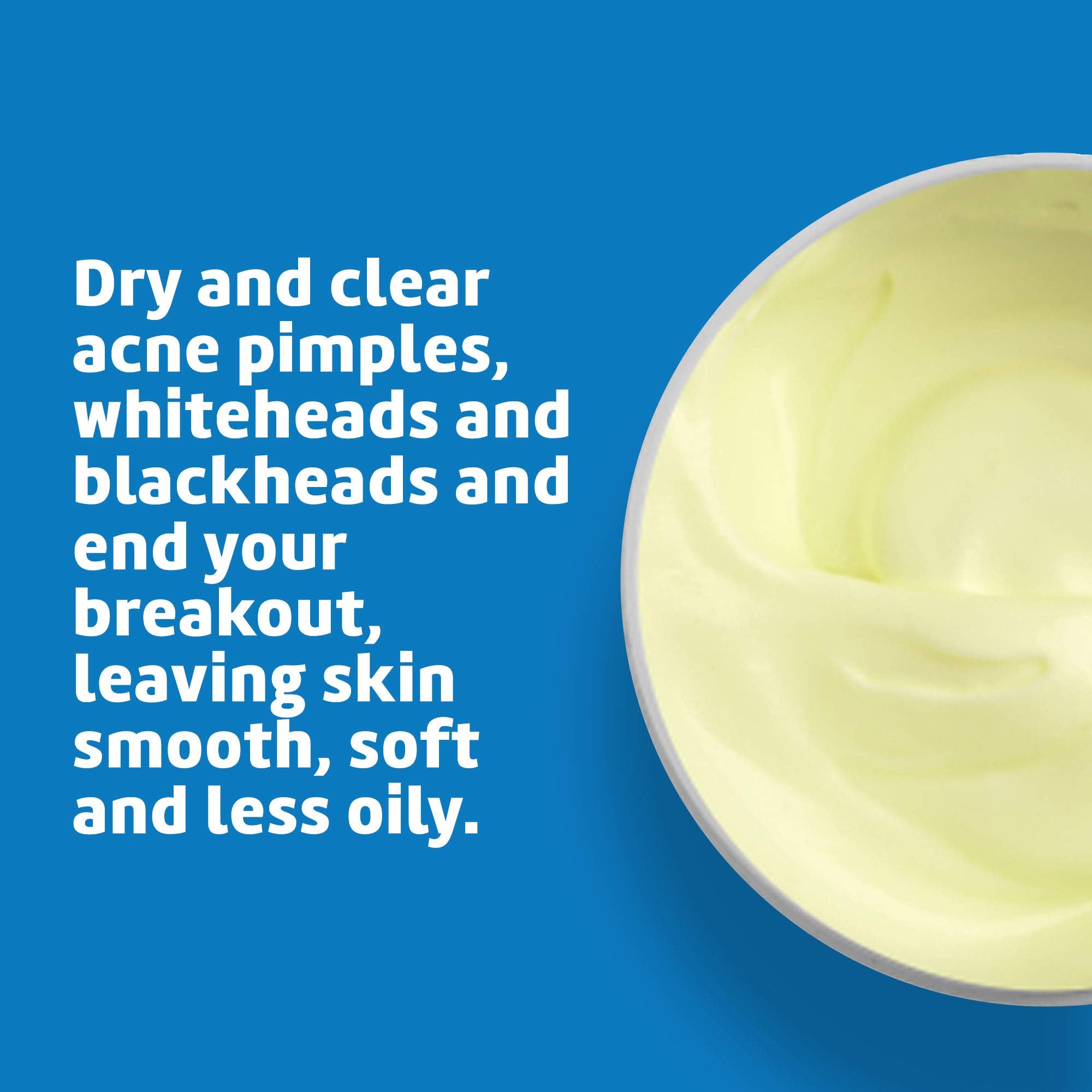 De La Cruz sulfur ointment applied to a chin blemish.