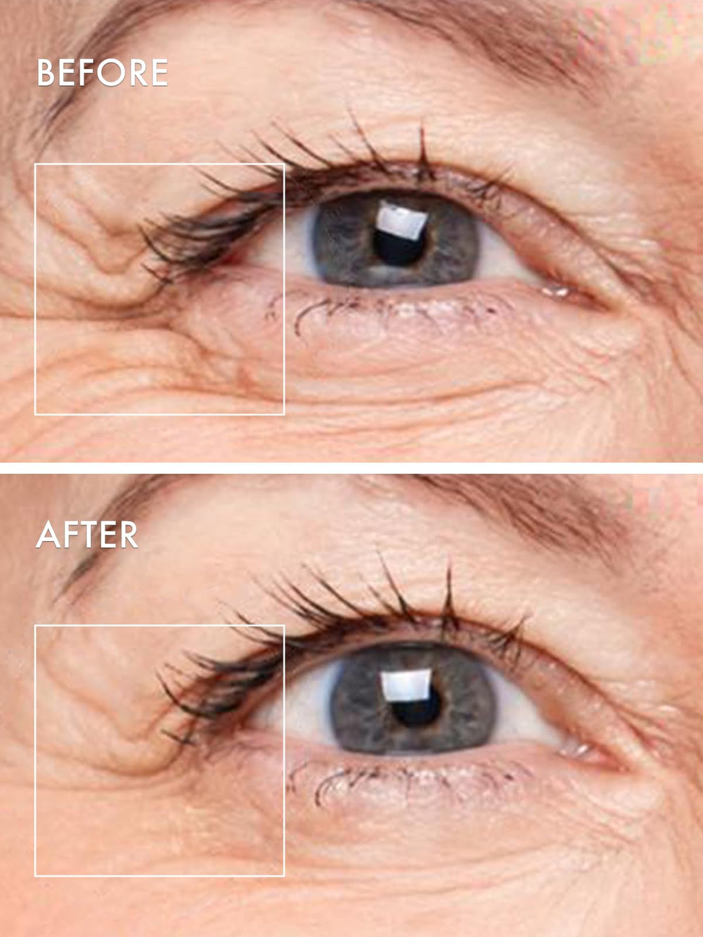 Depology Deepcare+ eye patches suited for fatigued and dehydrated skin.