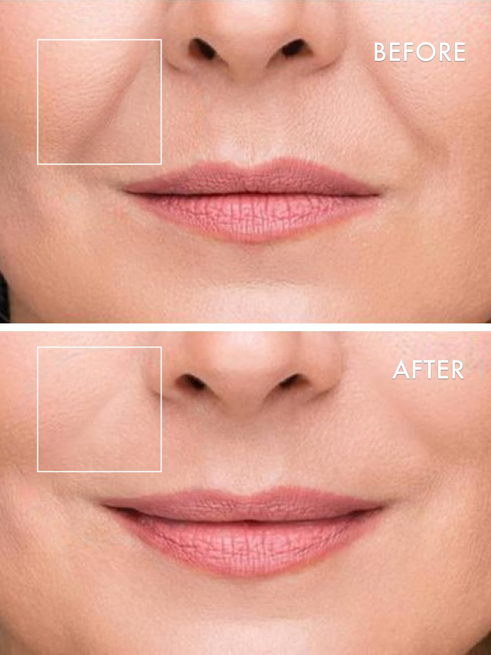 Depology Deepcare+ overnight wear may refresh the under-eye area.