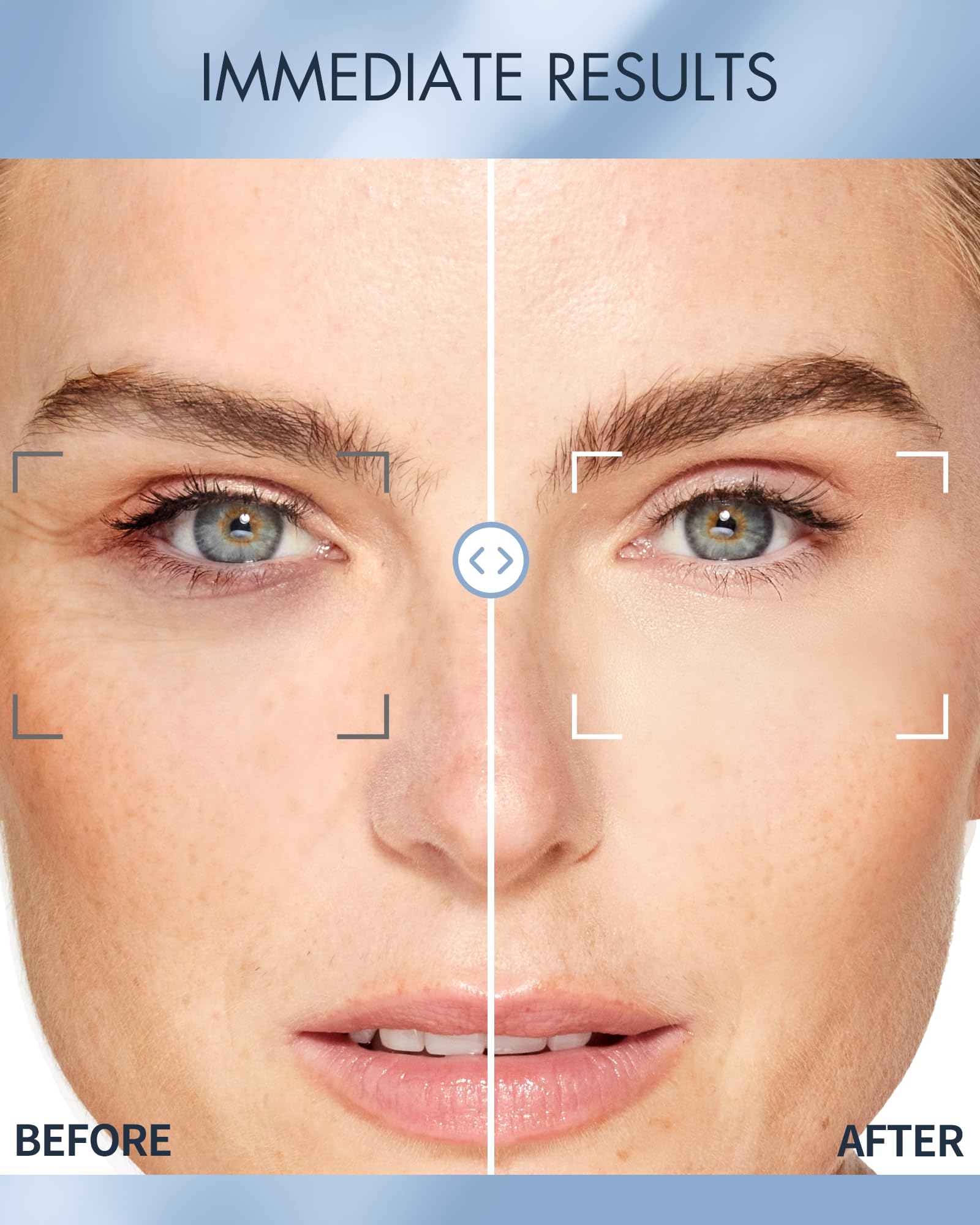 depology multi-area eye masks for forehead and laugh lines