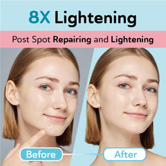 DERMA ANGEL patch targeting post‑acne dark spots for subtle brightening