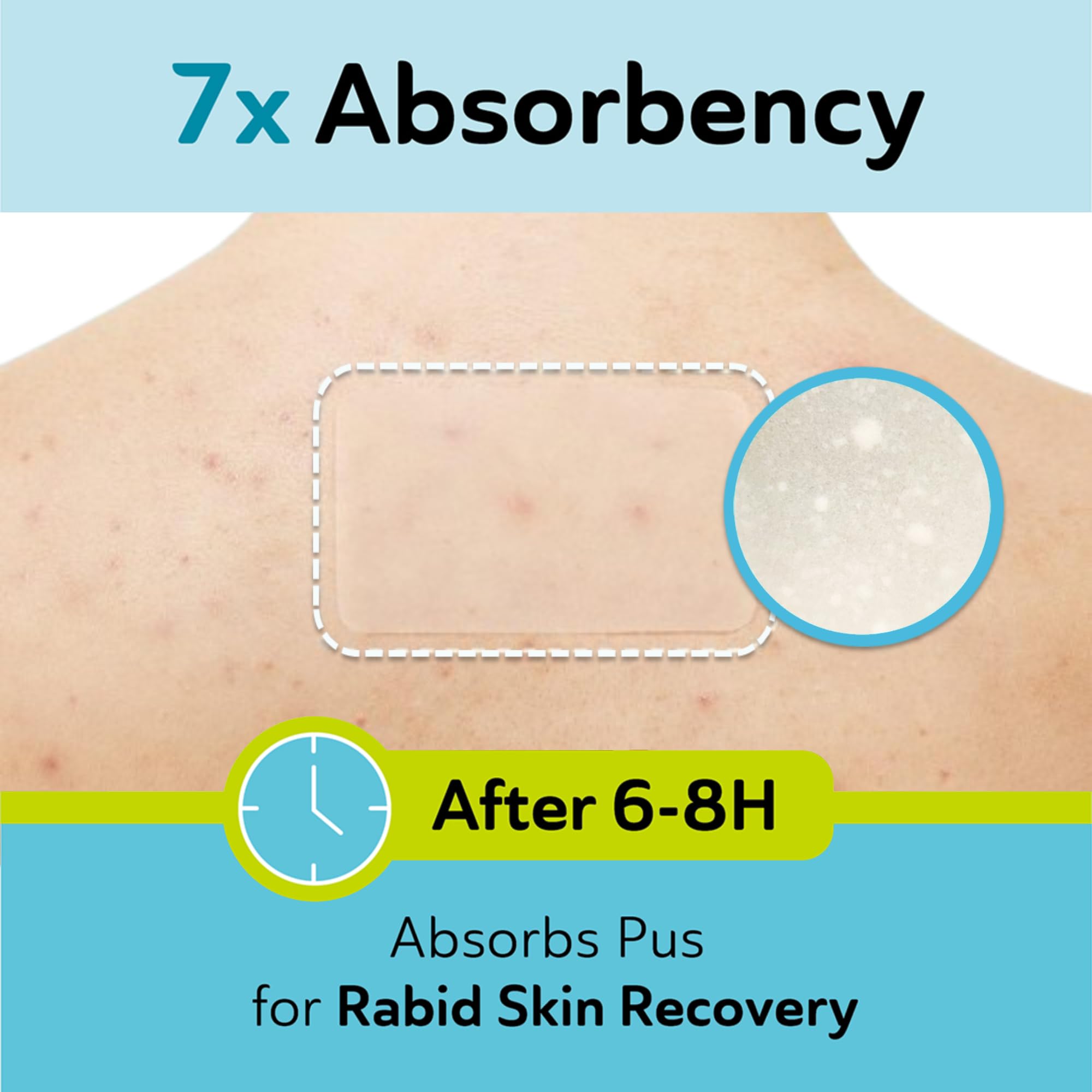 DERMA ANGEL large patch on the forehead area covers large blemishes invisibly.