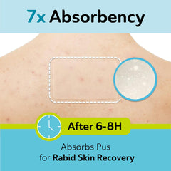 DERMA ANGEL large patch on the forehead area covers large blemishes invisibly.