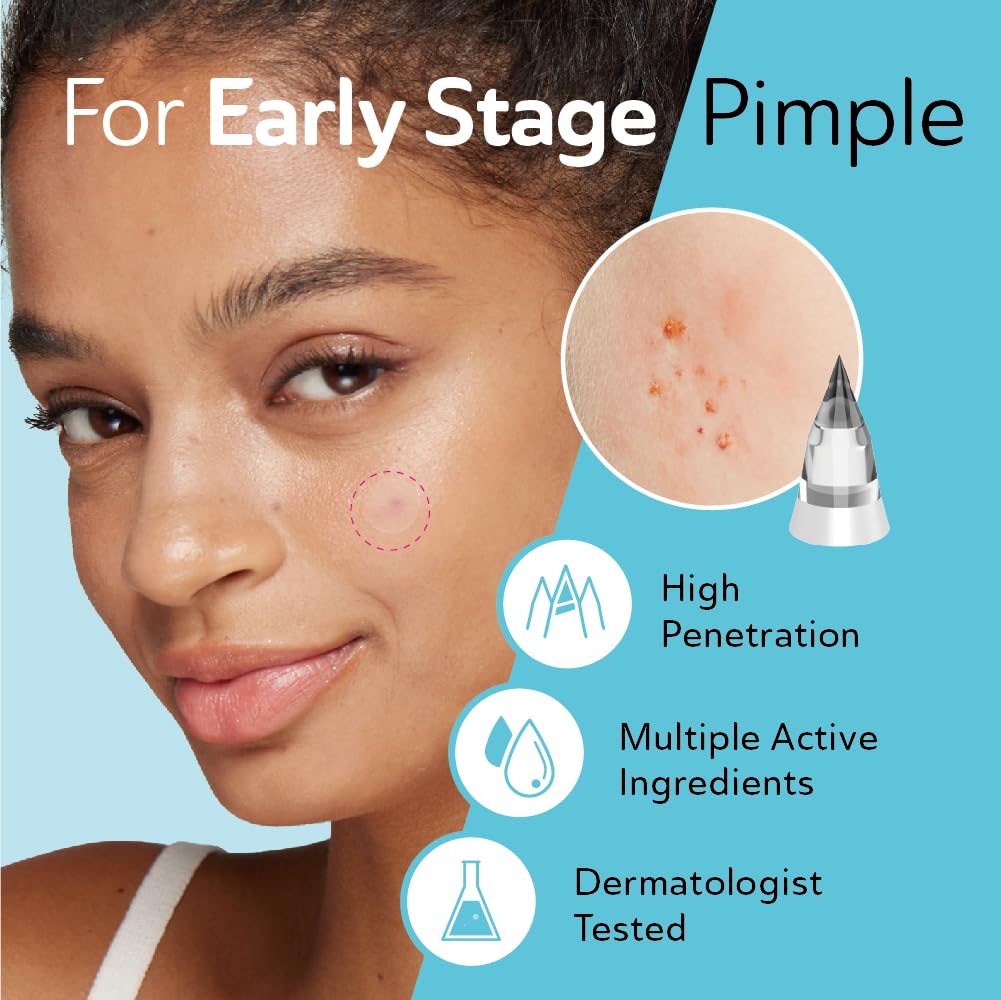 DERMA ANGEL patches with salicylic acid, azelaic acid, CICA, and vitamin C.