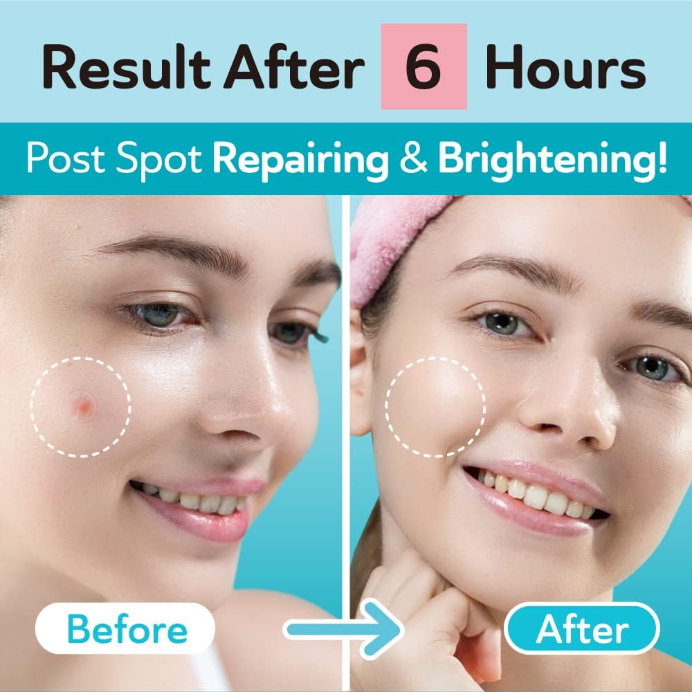 DERMA ANGEL night 12mm patch designed for overnight absorption