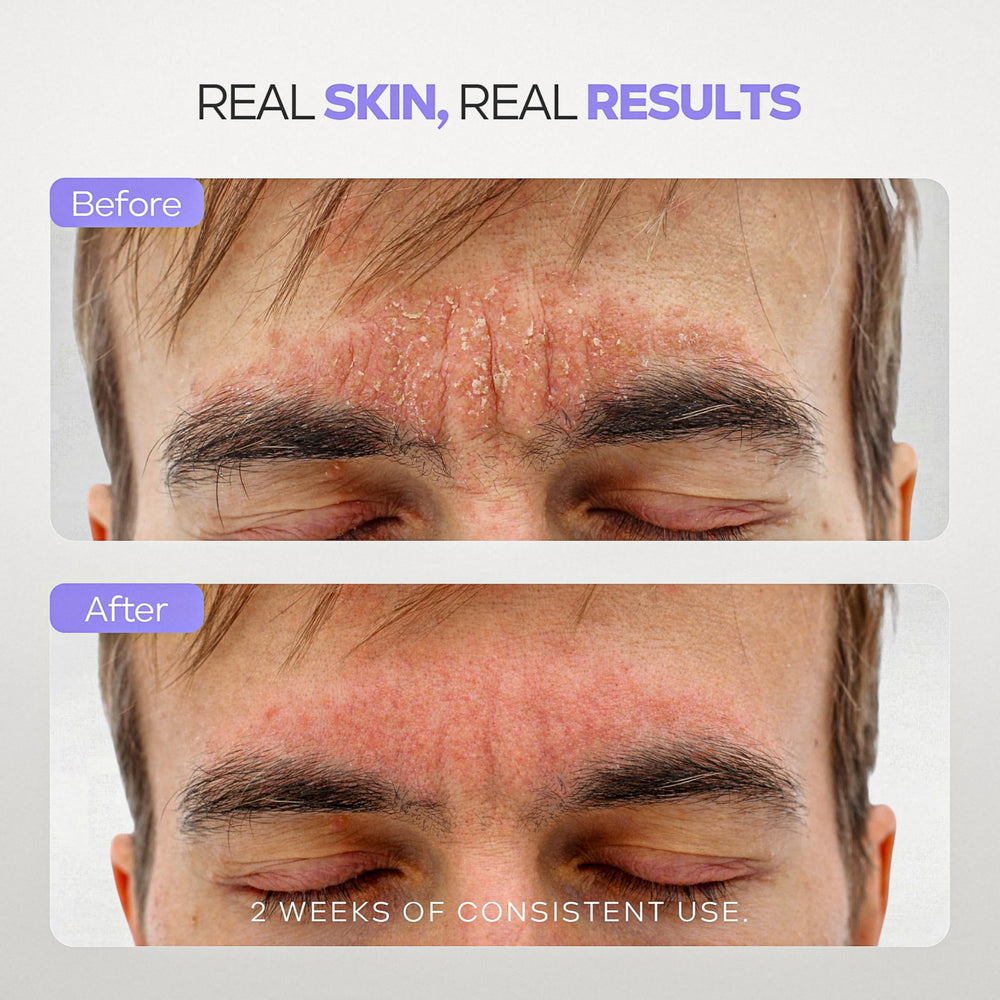 DERMAdoctor Fragrance-free lather — soap-free, dye-free cleansing.