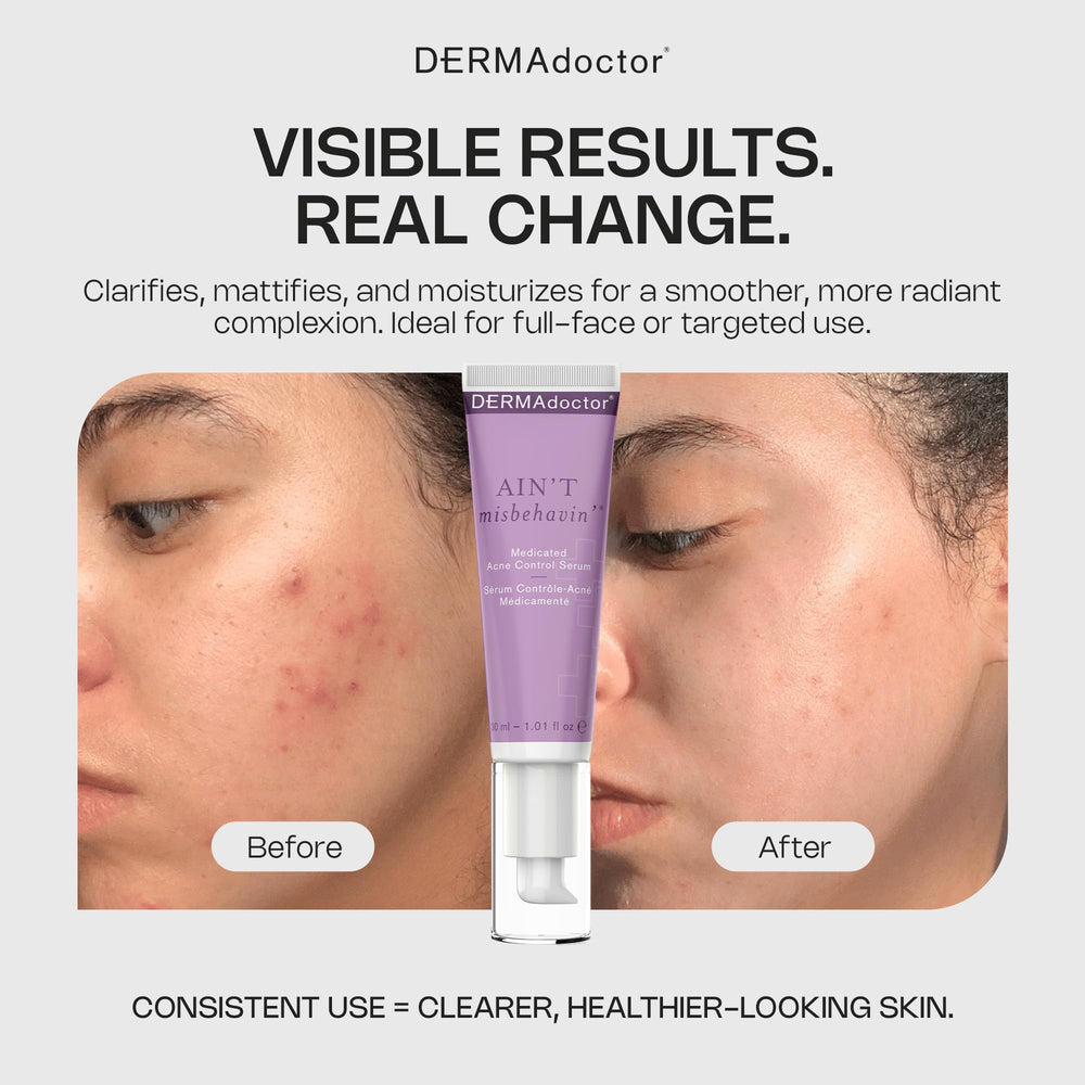 DERMAdoctor tea tree oil ingredient highlighted for soothing acne care