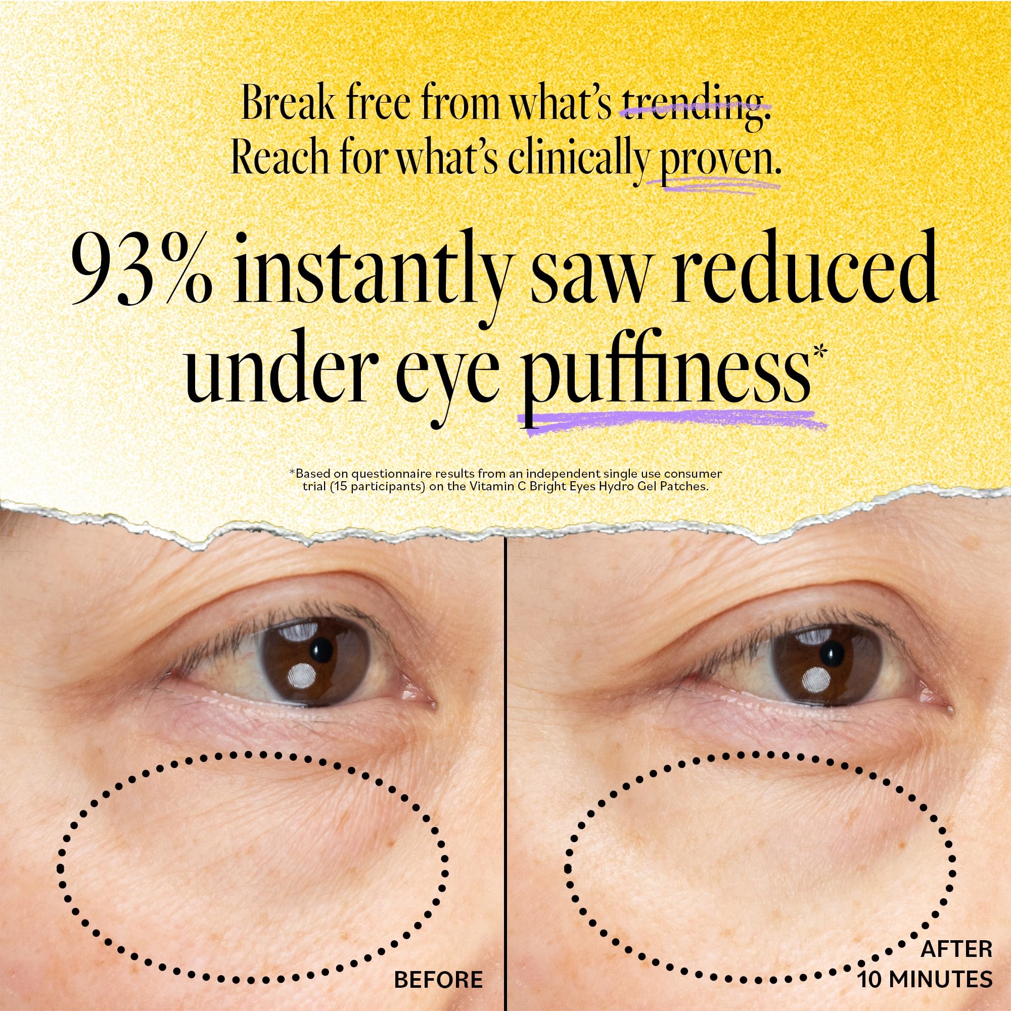 Derma E Hydrogel under-eye patches close-up delivering hydrating nourishment.