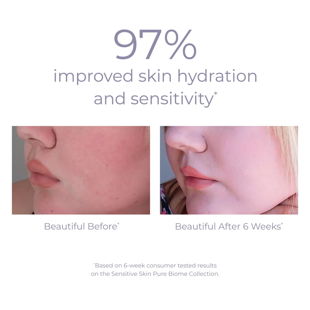 Application of Derma E Biome Balancing Cream on face and neck
