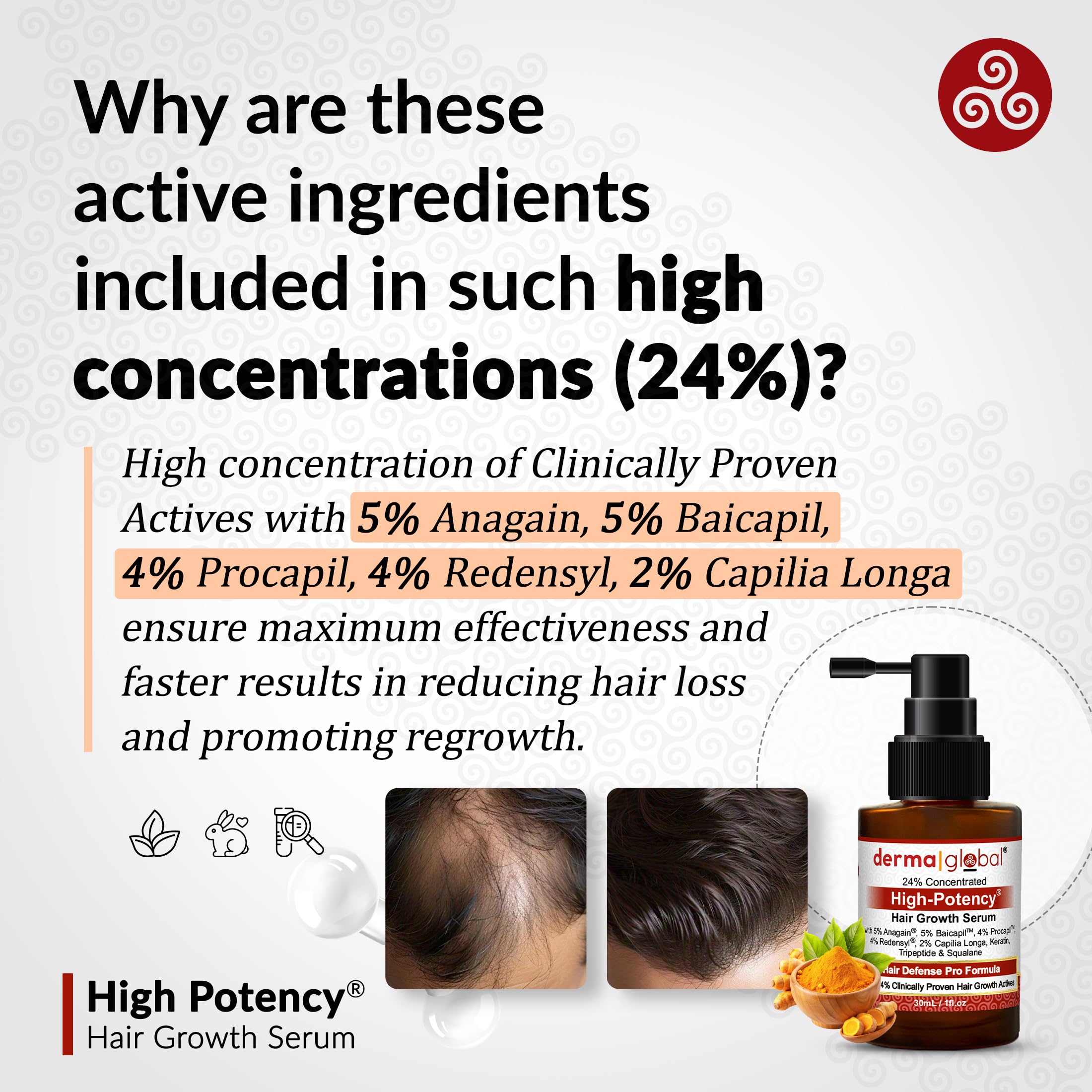 Derma Global ingredient panel highlighting Anagain, Baicapil, Redensyl actives