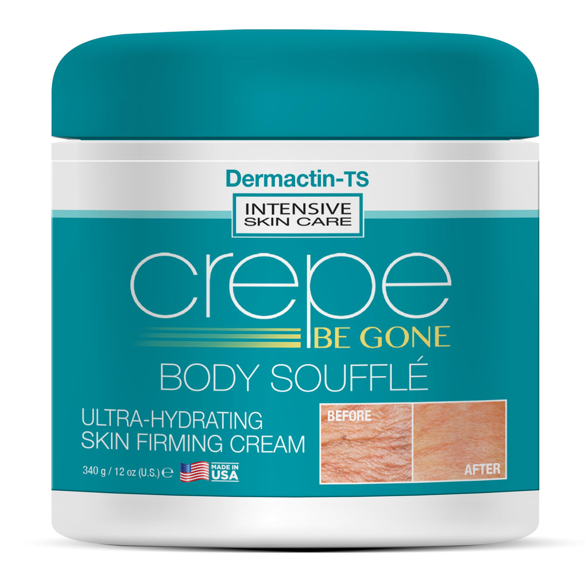 Dermactin Crepe Be Gone Body Souffle jar front view highlighting 12oz size.