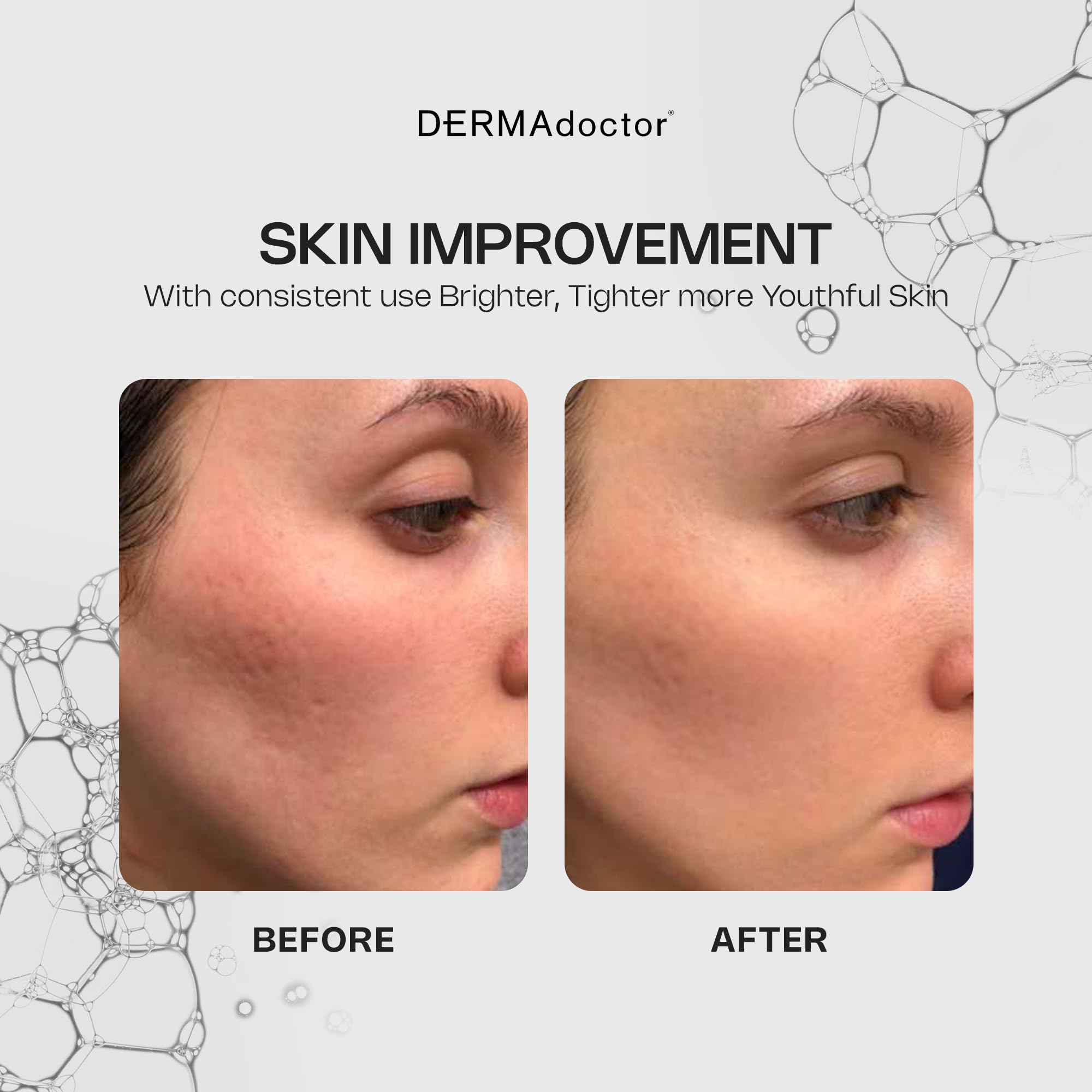 DERMADoctor Kakadu plum fruit highlighting antioxidant boost.