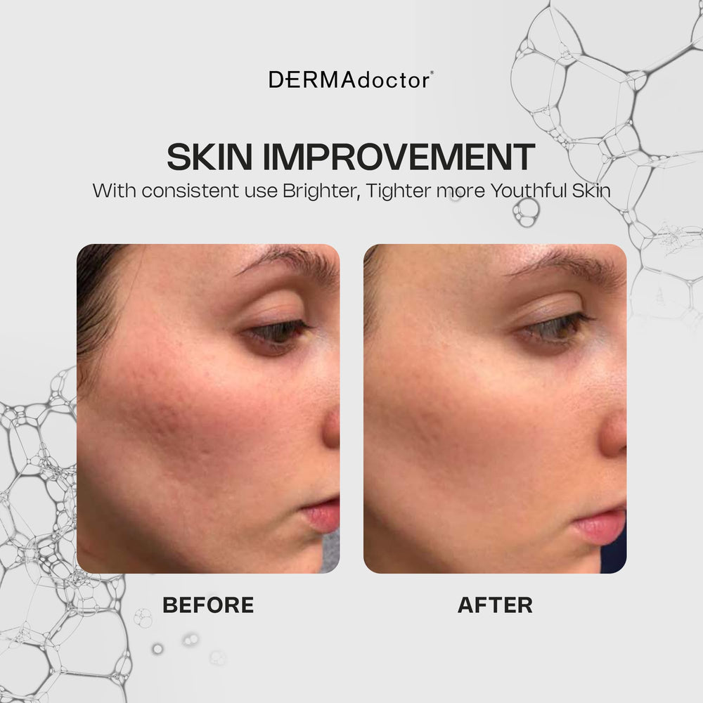 DERMADoctor Kakadu plum fruit highlighting antioxidant boost.