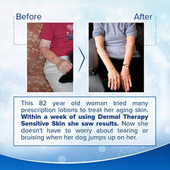 Dermal Therapy 15-percent allantoin ingredient close-up highlights soothing skin support.
