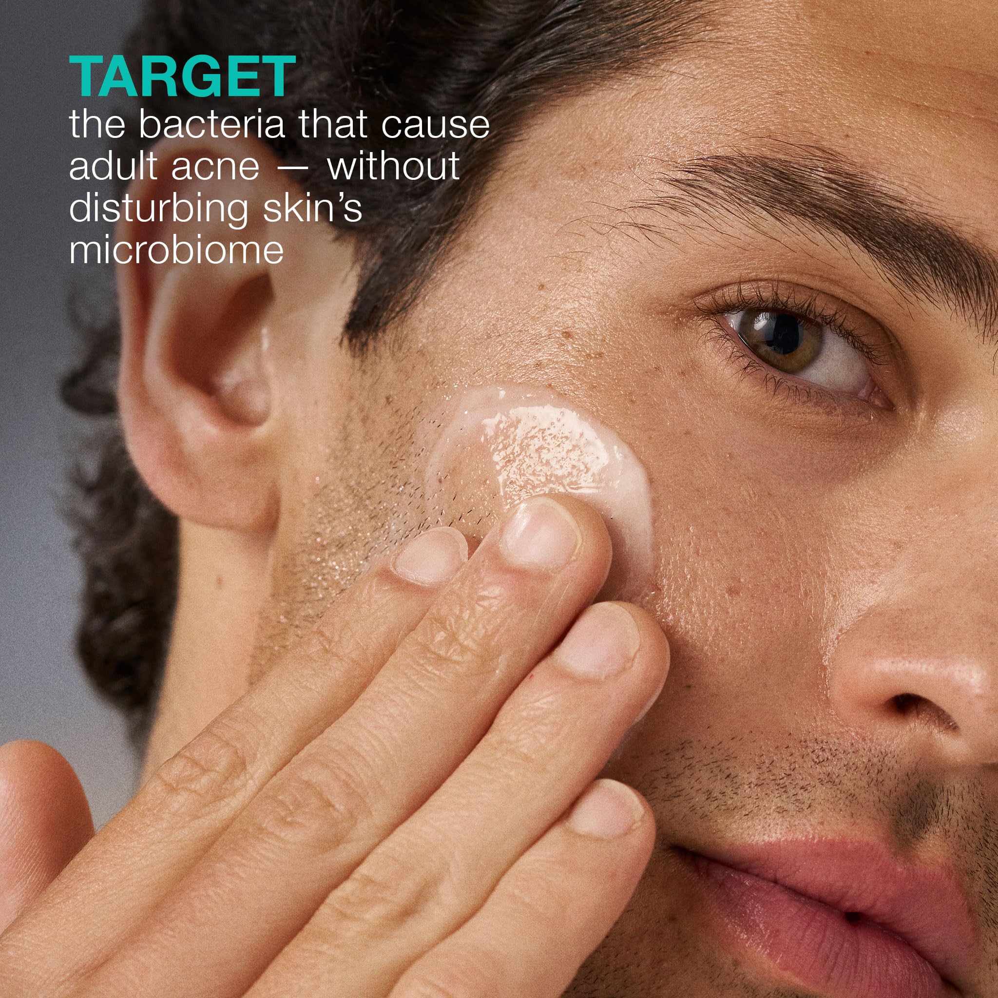 Dermalogica Acne Biotic lightweight gel suits aging-prone skin seeking balance.