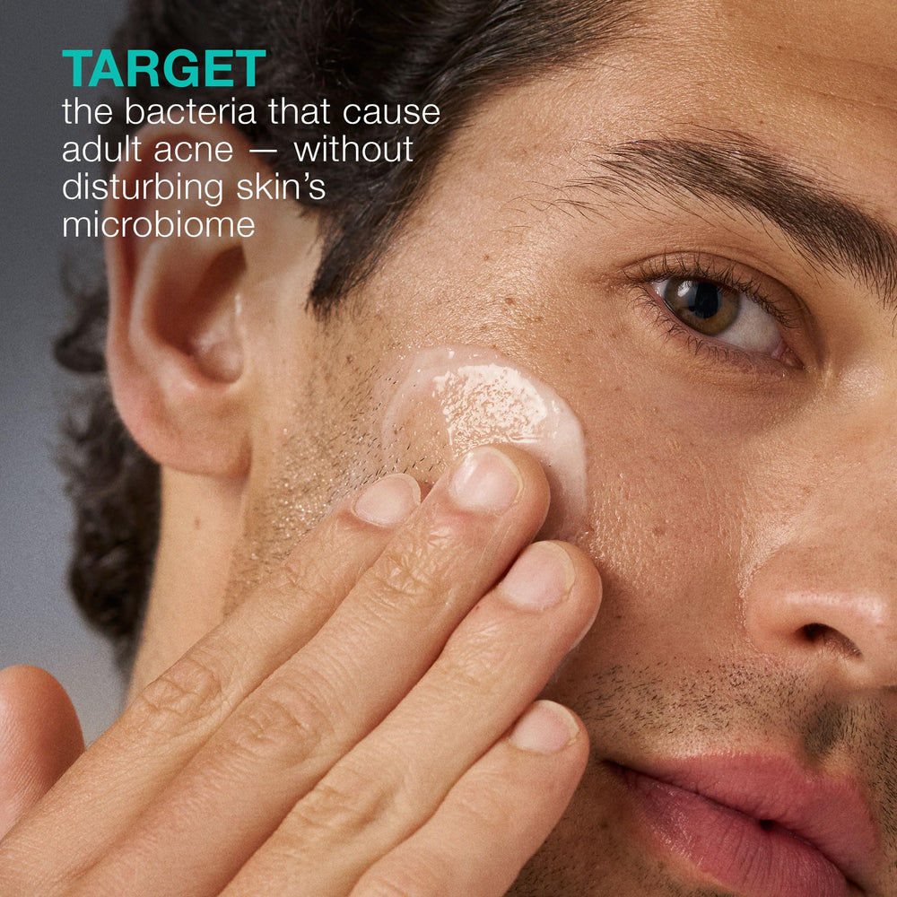 Dermalogica Acne Biotic lightweight gel suits aging-prone skin seeking balance.