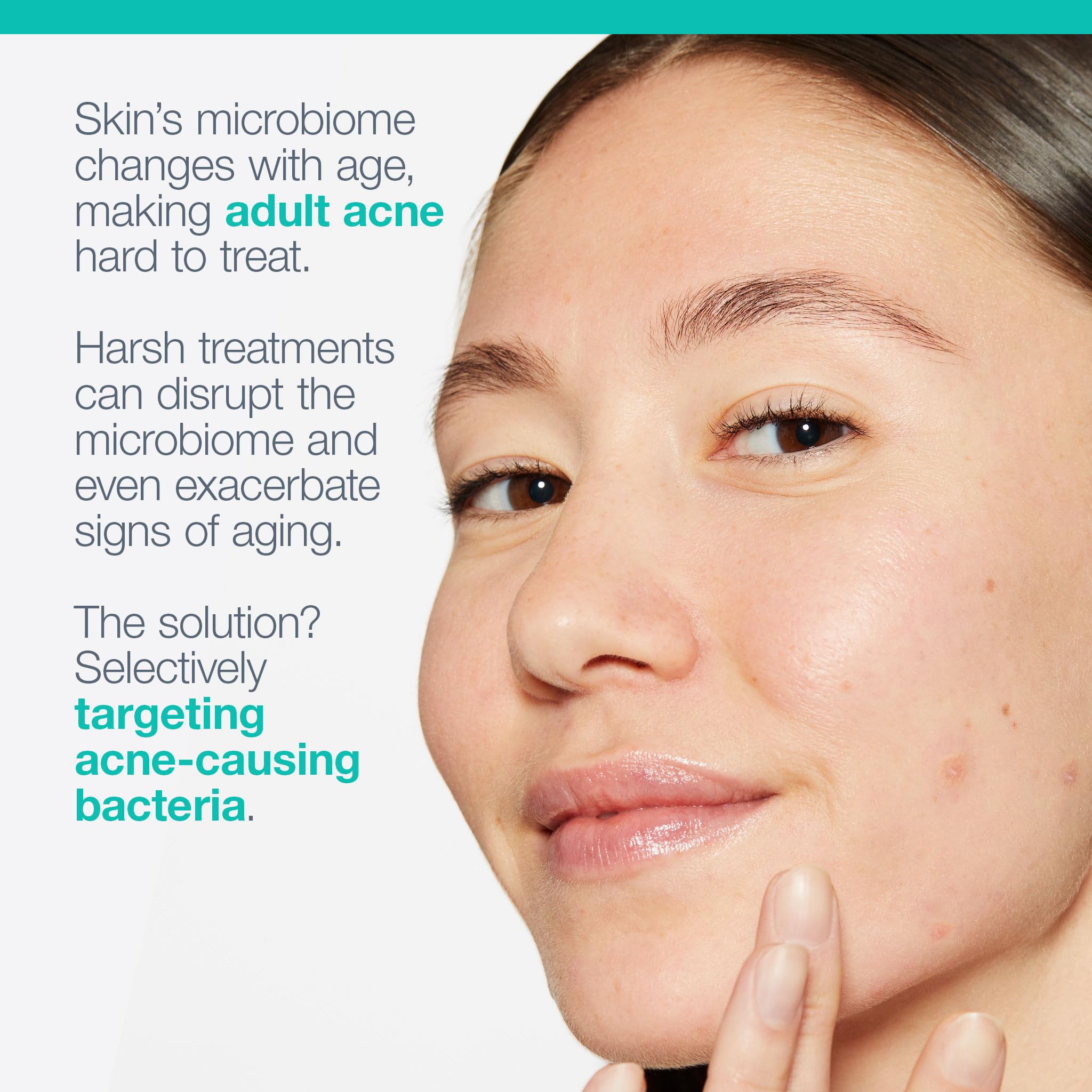 Dermalogica Acne Biotic with Manuka and Magnolia extracts balances oil and complexion.