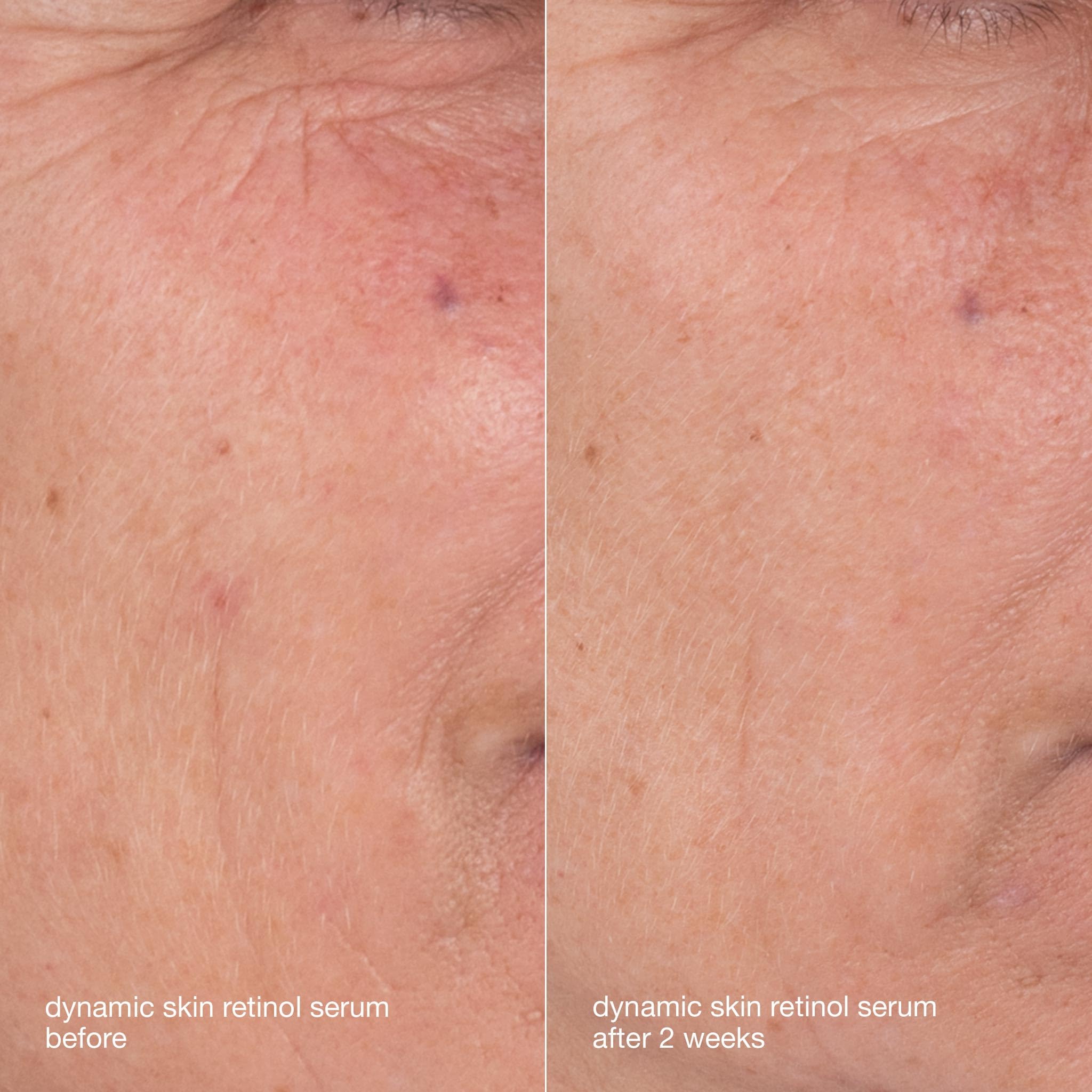 Dermalogica Skin Aging Kit cream texture close-up emphasizes rich nourishment