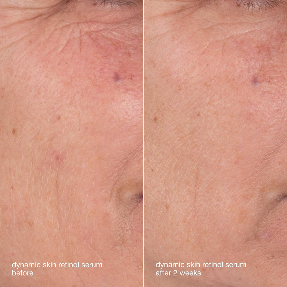 Dermalogica Skin Aging Kit cream texture close-up emphasizes rich nourishment