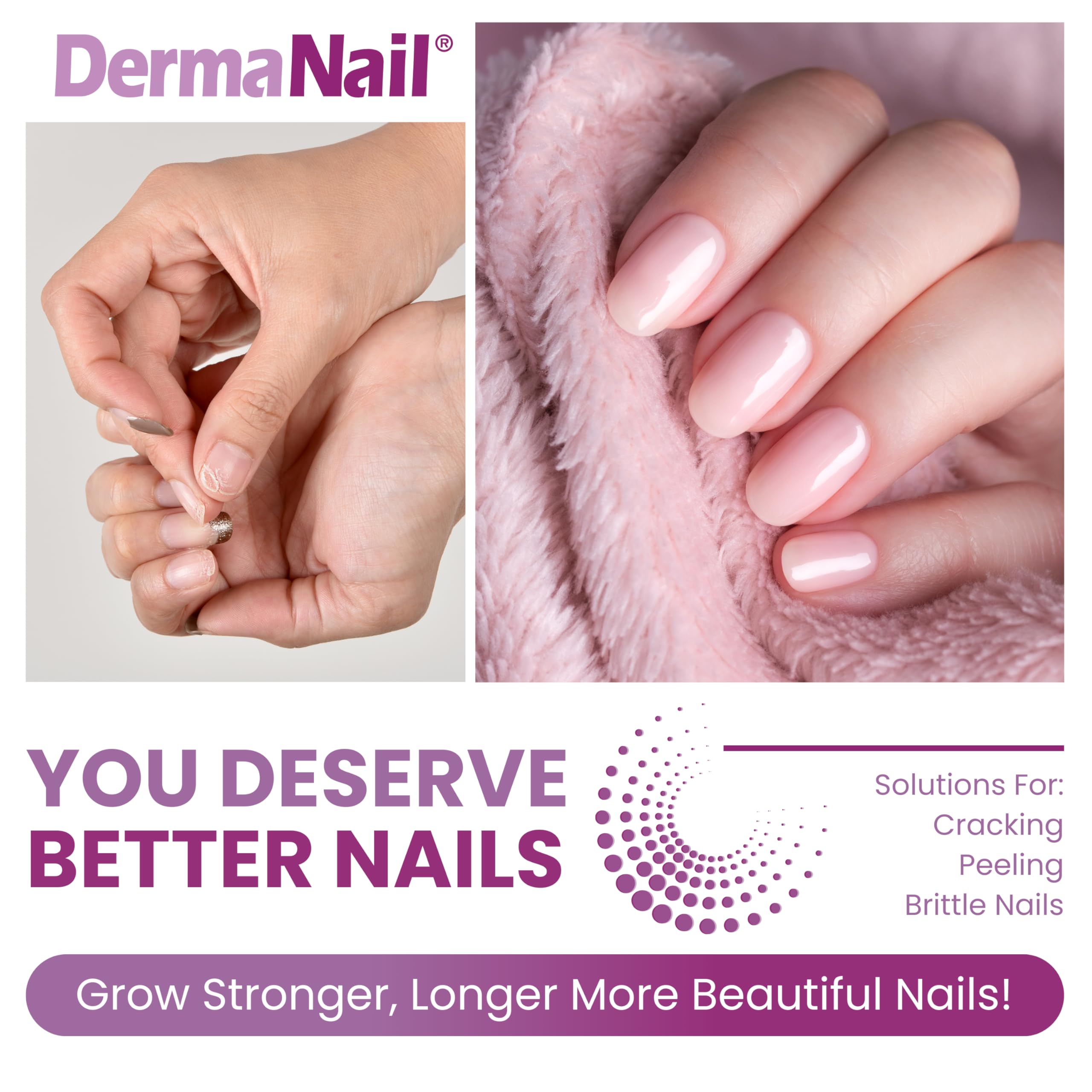 DermaNail Cutemol cream tube moisturizes nails and cuticles.
