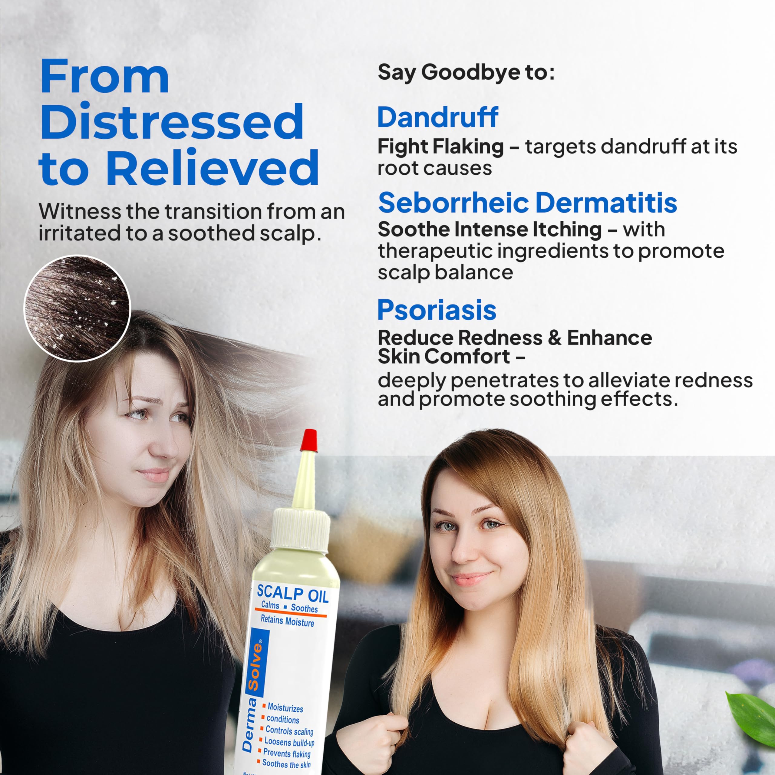 Dermasolve scalp oil packaging close-up emphasizes premium dermatologist-approved care