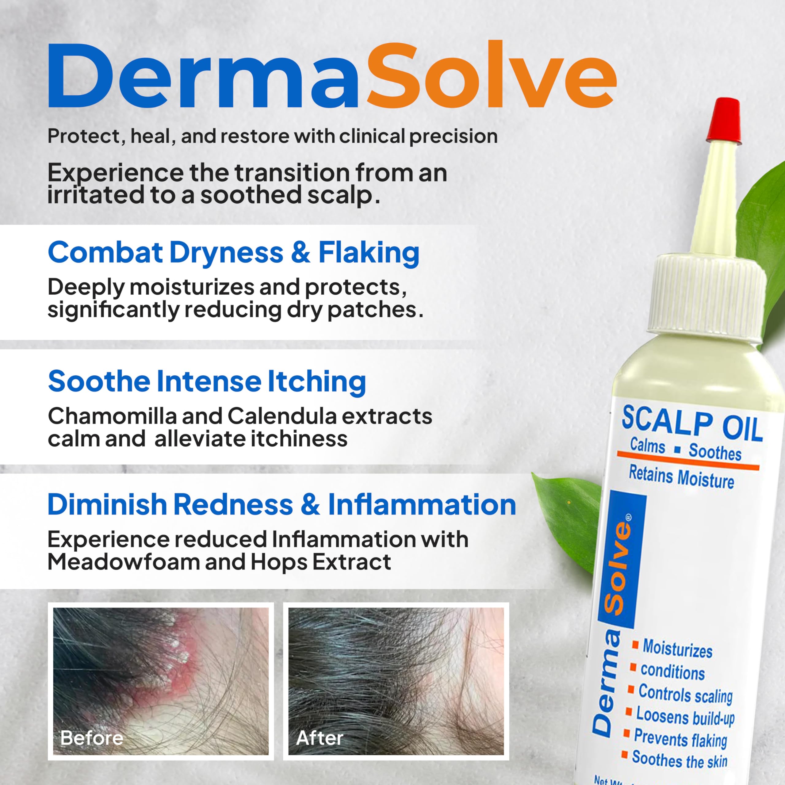 Dermasolve scalp oil pour demonstrates easy application for daily care and comfort