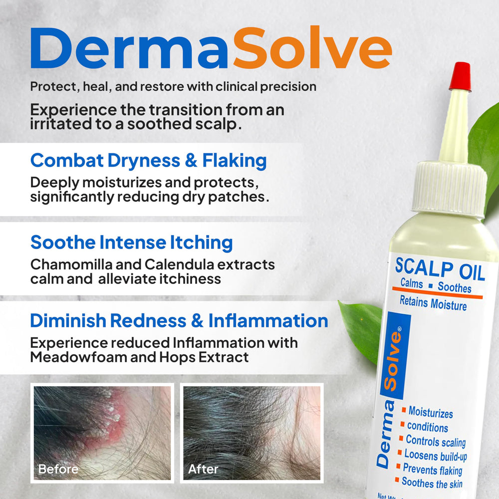 Dermasolve scalp oil pour demonstrates easy application for daily care and comfort