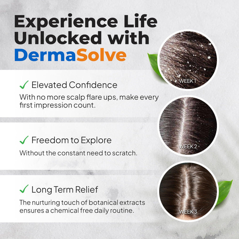 Dermasolve scalp close-up shows relief from itching during use.