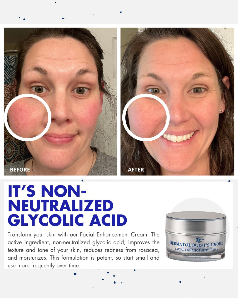 Dermatologist's Choice cream texture swirl showcasing luxurious whipped consistency for nourishment.