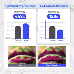 Lip mask texture shown for overnight nourishment