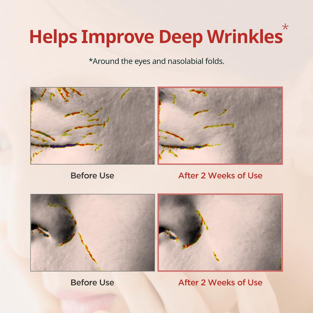 DERMATORY Pro Vita-A Under Eye Patch close-up highlighting retinal and botanical ingredients