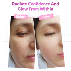 DERMATOUCH Hyaluronic acid boost visible in the tube, signaling moisture support.
