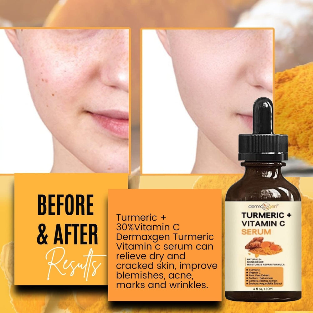 DERMAXGEN serum on hand image showing easy daily use