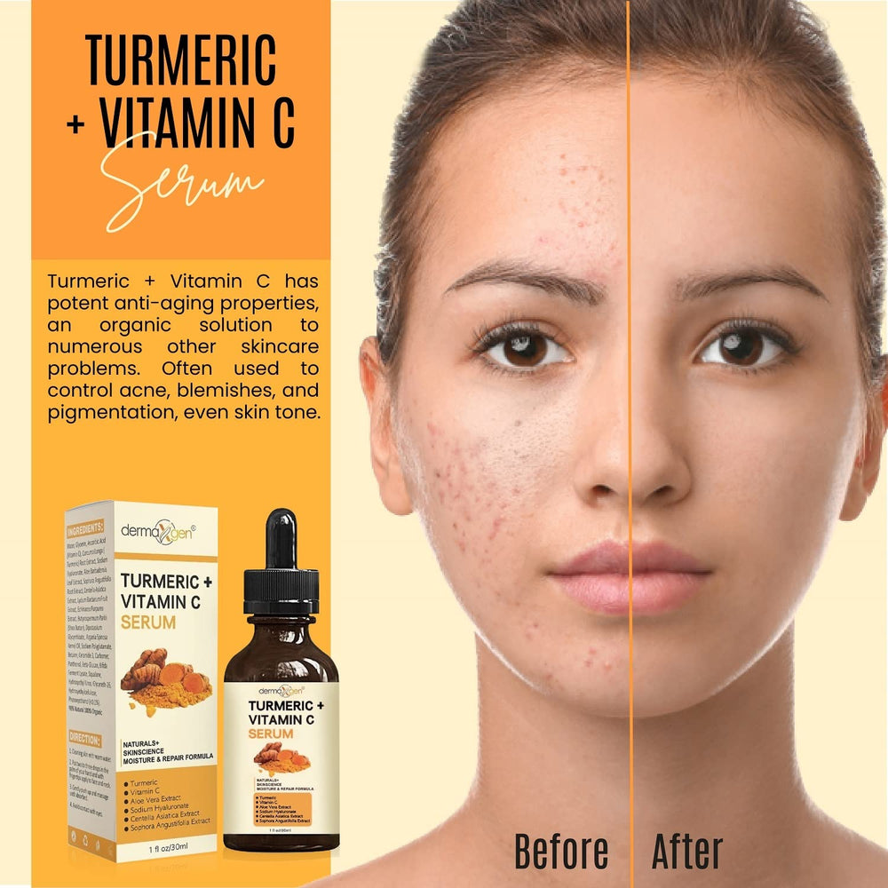 DERMAXGEN Turmeric + Vitamin C Serum ingredients illustration emphasizes aloe and hyaluronic acid