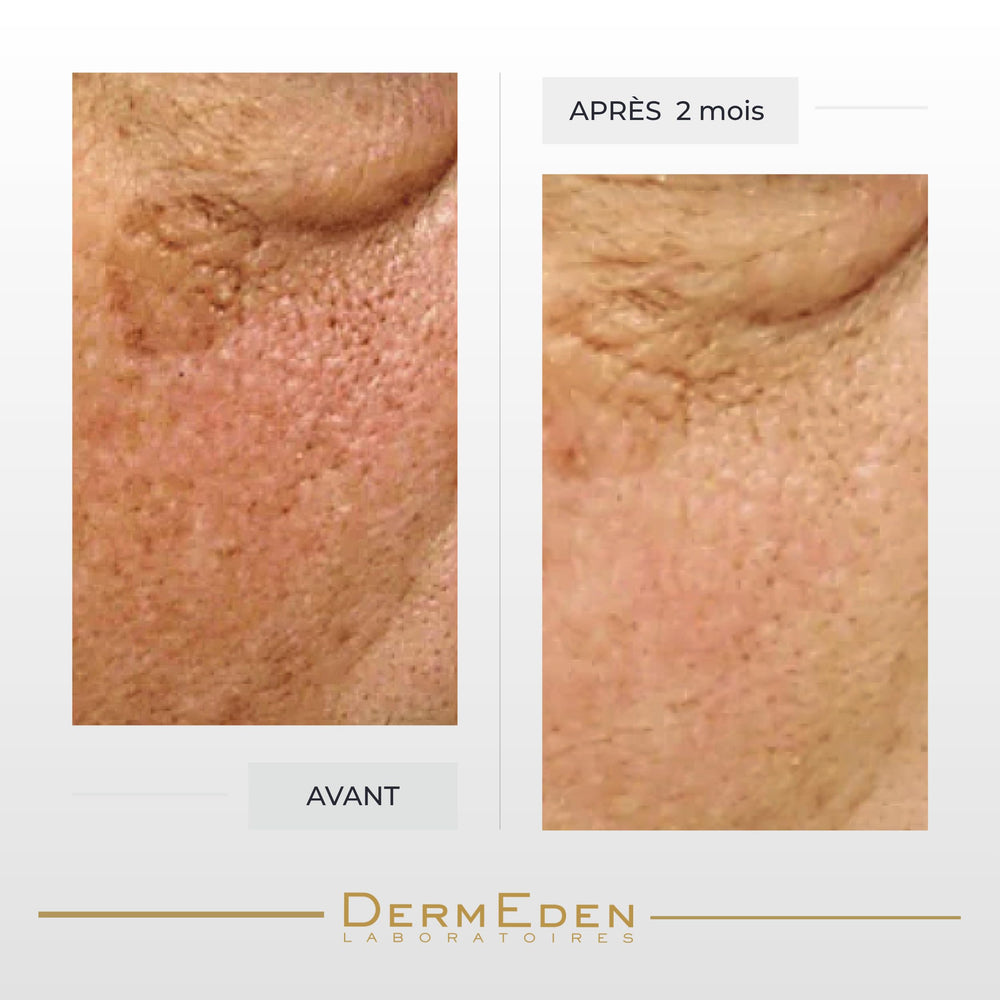 DERMEDEN Night Protocol Eye Cream box for premium gifting and display