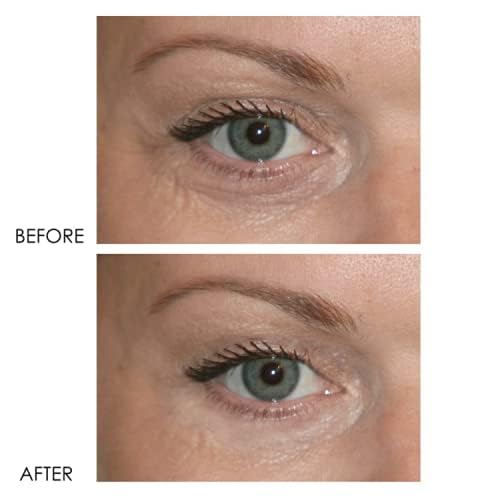 Dermelect Revitalite close-up showing smooth lid area after application.