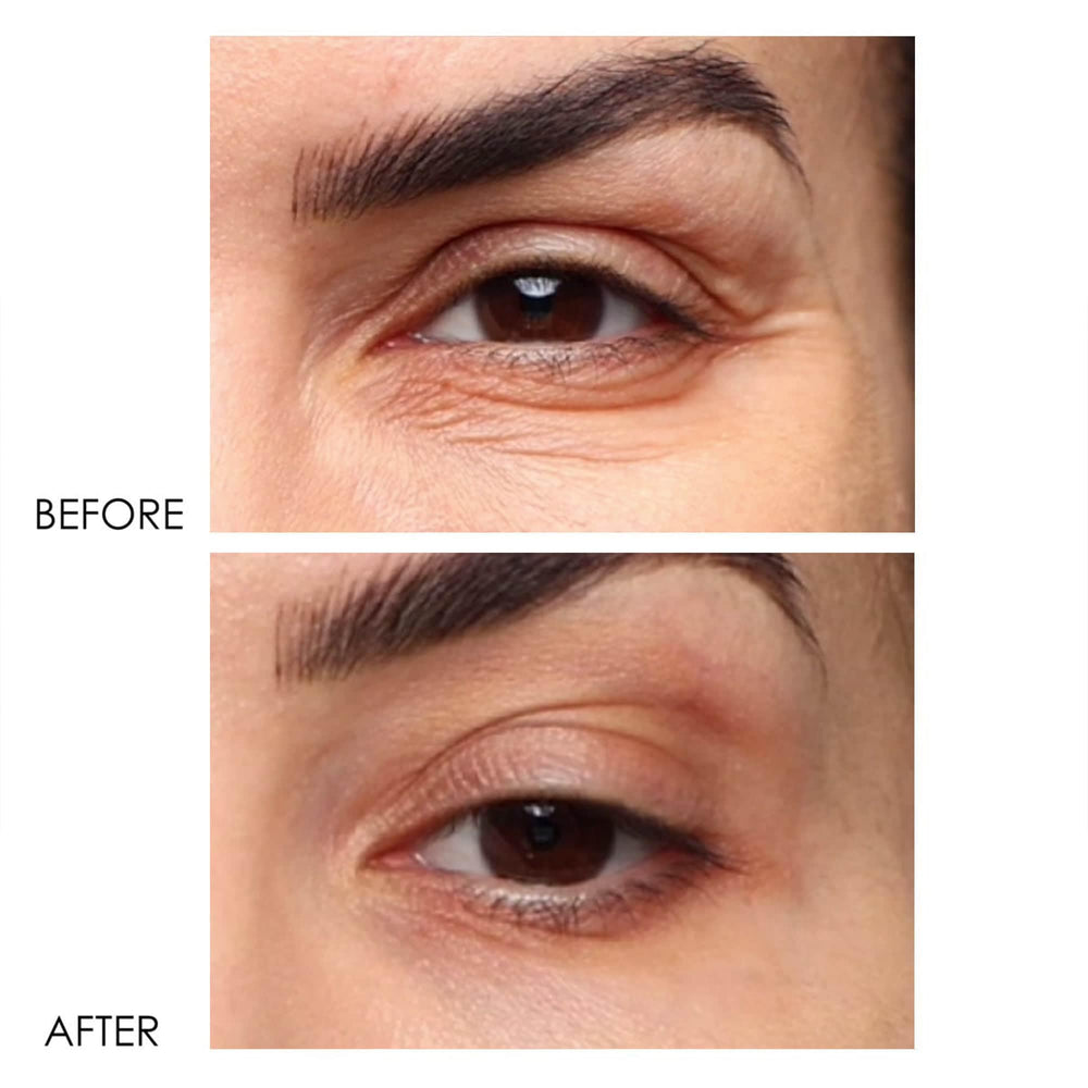Dermelect Revitalite packaging box showcasing 5-in-1 eye care formula.