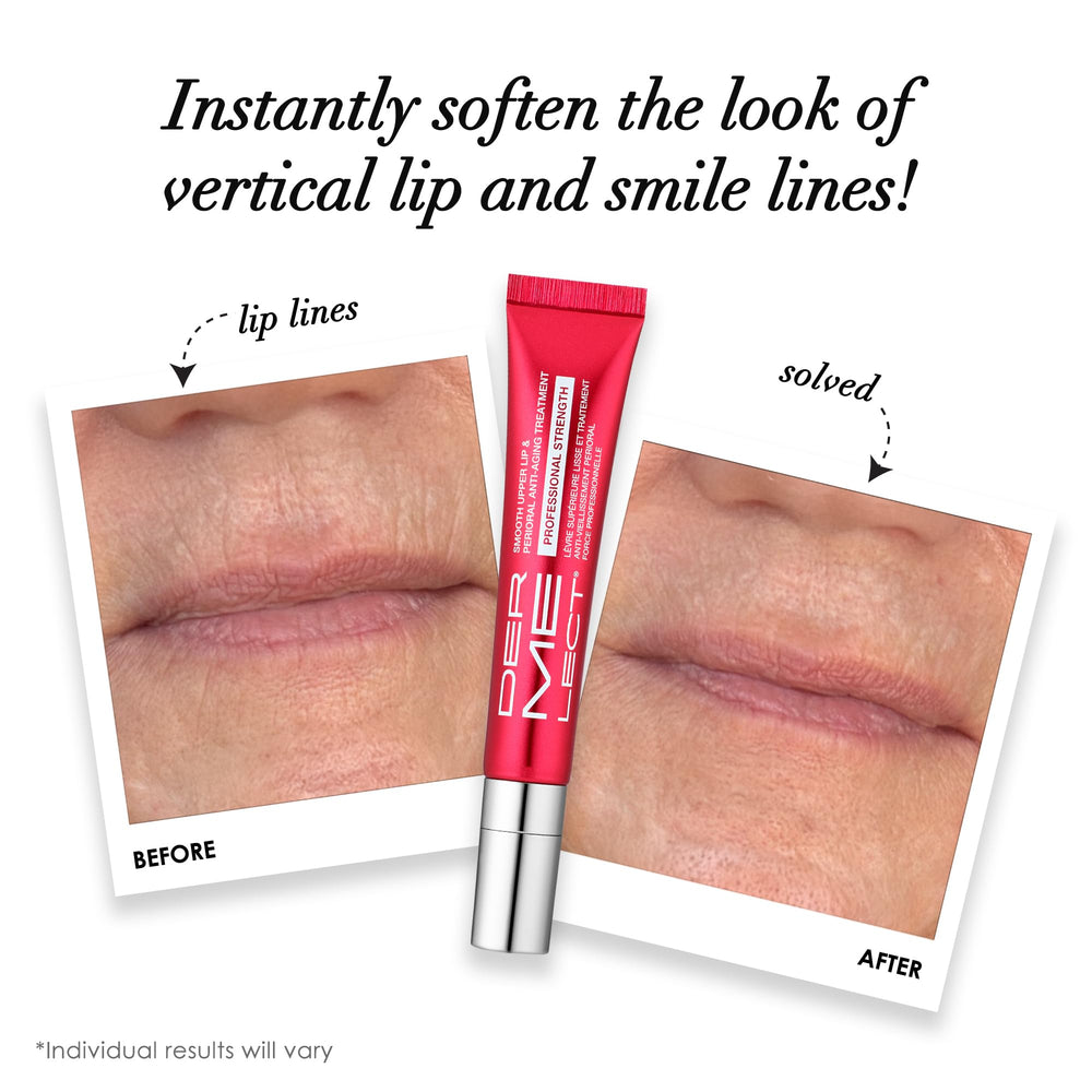 Dermelect Smooth Upper Lip ceramic applicator tip enables targeted, clean application.