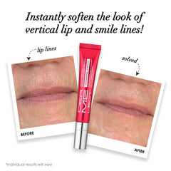 Dermelect Smooth Upper Lip ceramic applicator tip enables targeted, clean application.