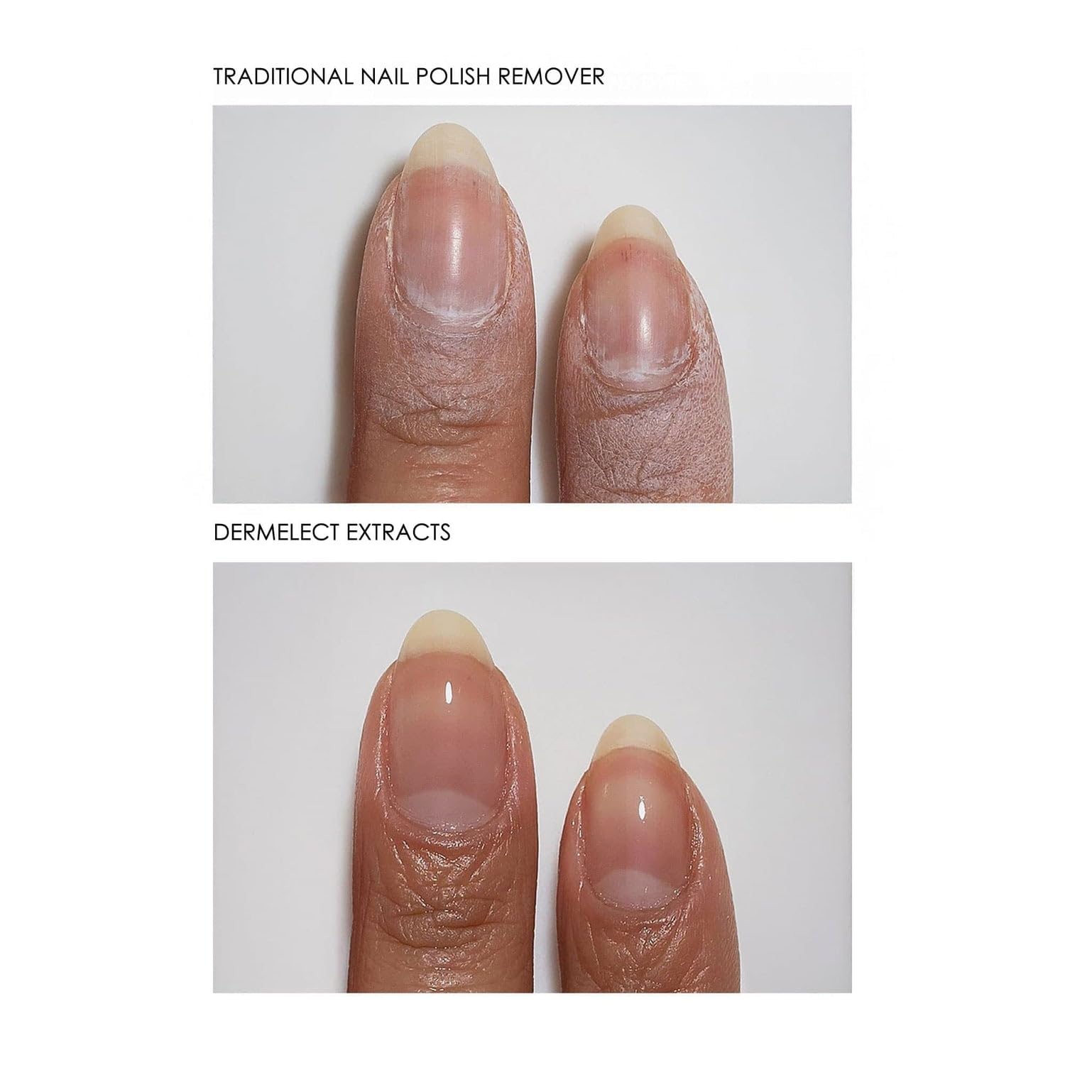 Dermelect travel-friendly kit for mess-free on-the-go care.