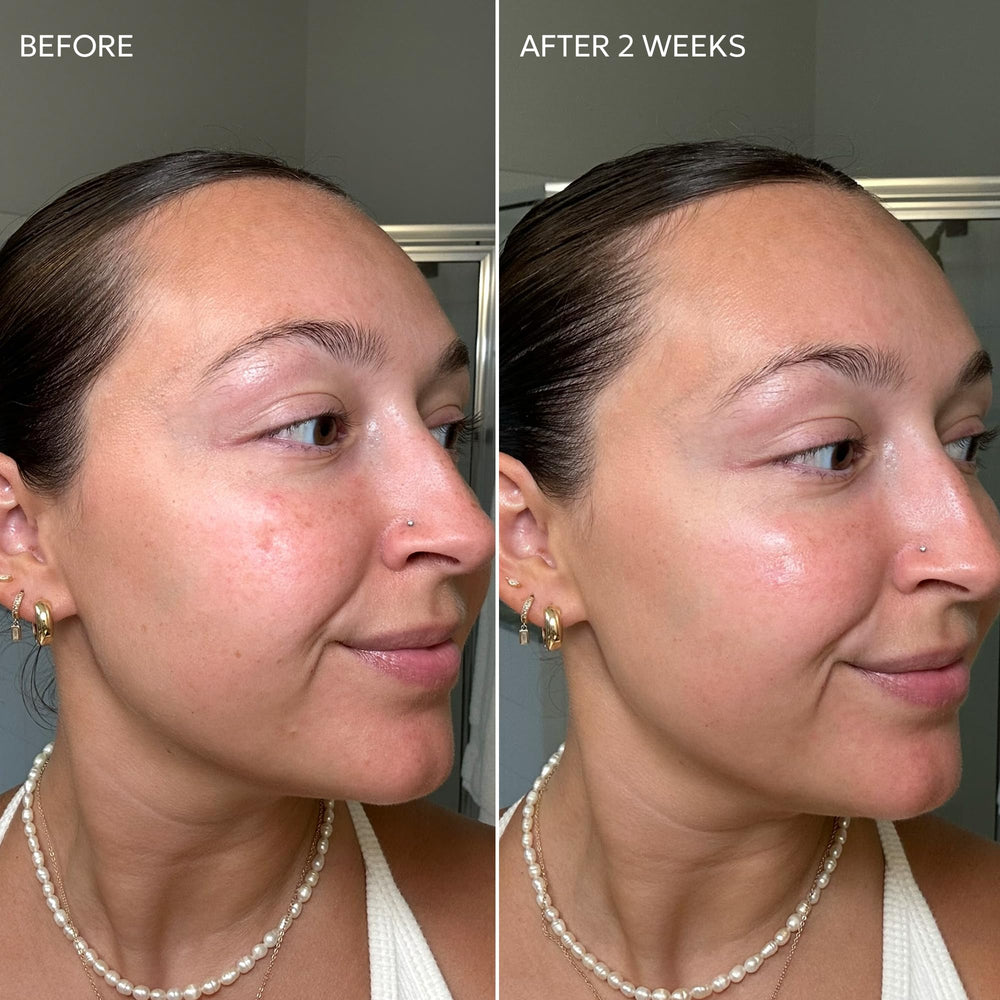 Dermisa Skin Fade Cream application routine on clean skin.